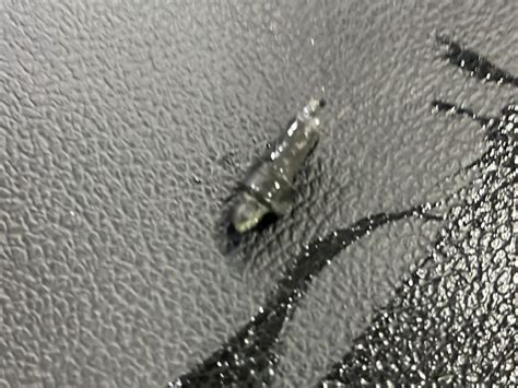 Ahmedabad Girl Undergoes Emergency Surgery After Swallowing Whistle ...