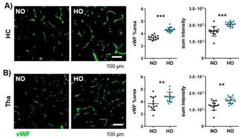 Cells | Special Issue : Perinatal Brain Injury—from Pathophysiology to ...