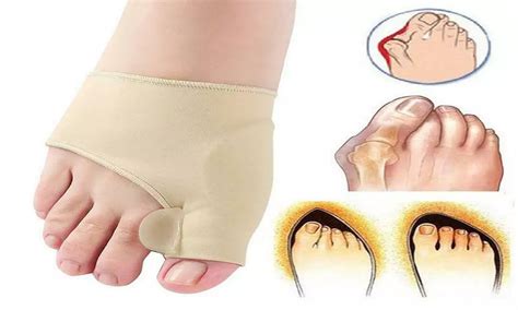 Bunion Corrector Orthopedic F... | Groupon Goods
