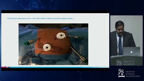 Image result for Nephrectomy Positioning