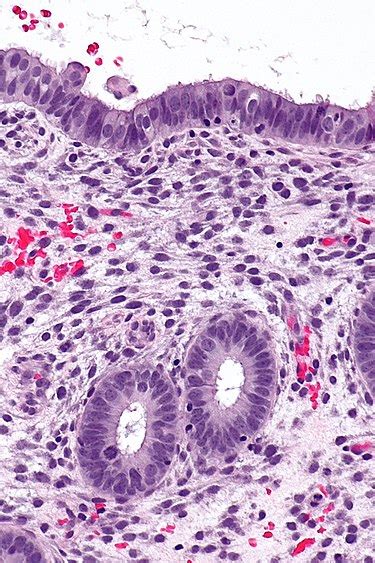 Image result for Endometrium Functional Layer