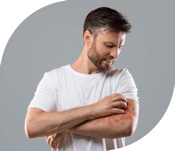 Swaarnim Psoriasis Care | Complete relief from Rashes and Allergies No ...