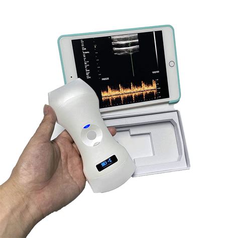 Ultrasound Scanner, Wholesale Ultrasound Scanner Suppliers and Manufacturers - Henan Forever ...