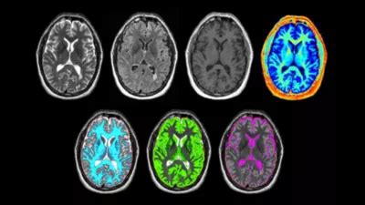Philips - SyntAc MR Clinical application