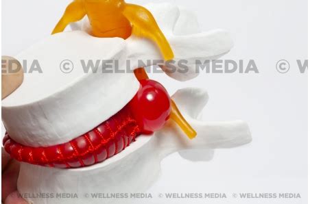 Disk Problem 的图像结果