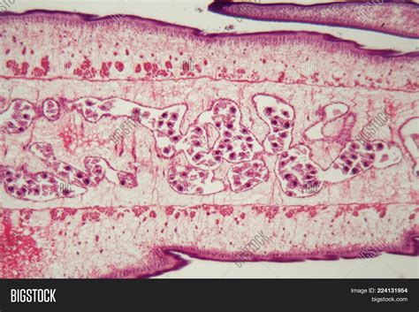 Tapeworm Proglottids
