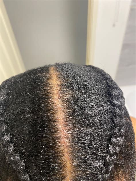 red slightly raised bumps on lips : r/HPV