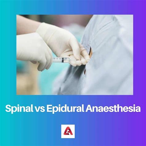 Spinale versus epidurale anesthesie: verschil en vergelijking
