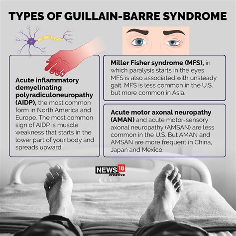 Syndrome Neurologique De Guillain Barré – DYKOT