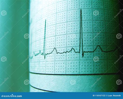 Sinus Heart Rhythm On Electrocardiogram Record Paper Showing Normal P Wave, PR And QT Interval ...