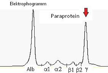 Scharnier Wert Eingestehen blutwert kappa zu hoch verblassen Aufregung ...