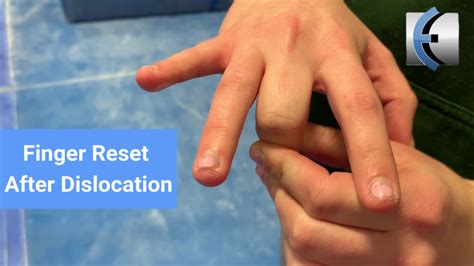 Image result for Finger Dislocation Treatment