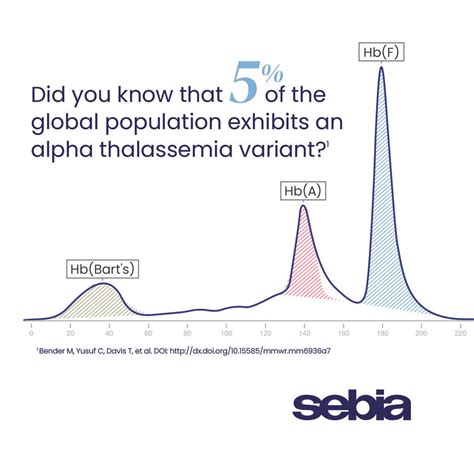 Sebia USA on LinkedIn: #hemoglobin #thalassemia #CAPILLARYS - Hemoglobin E