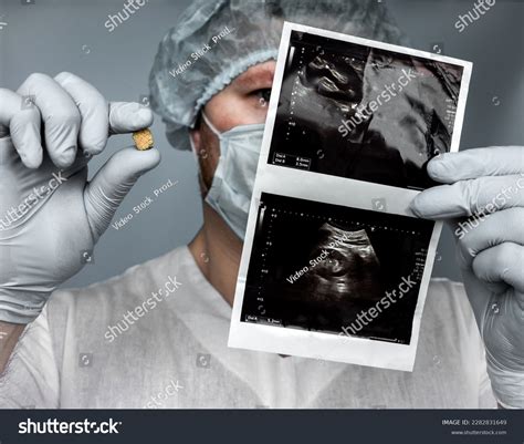 Kidney Stone Ultrasound