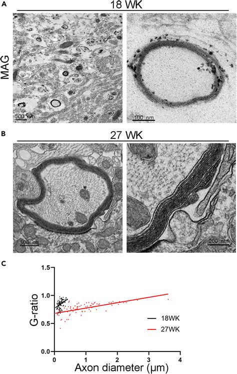 Developing a human iPSC-derived three-dimensional myelin spheroid platform for modeling myelin ...