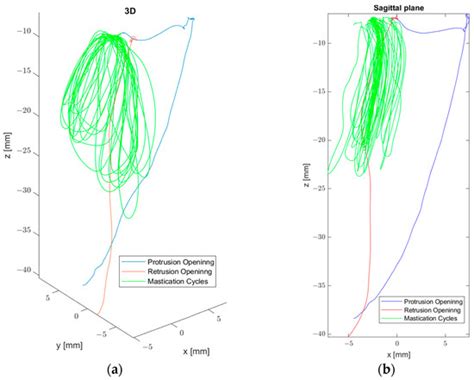 Chewing Analysis by Means of Electromagnetic Articulography: Current ...