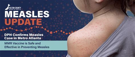DPH Confirms Measles Case in Metro Atlanta MMR Vaccine is Safe and ...