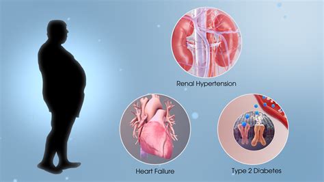 Metabolic Syndrome shown using 3D medical animation still shot