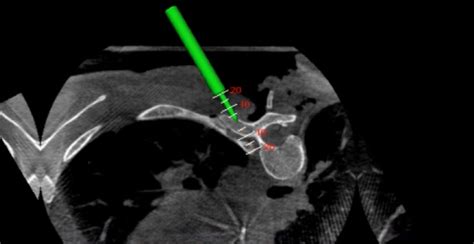 Computer Surgery 的图像结果