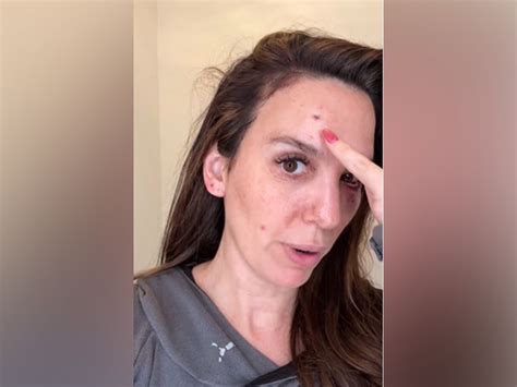 Christy Carlson Romano shares she was "shot in the eye" during husband ...