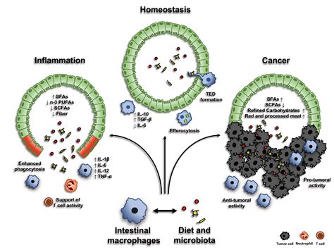 Intestinal Macrophages at the Crossroad between Diet, Inflammation, and ...