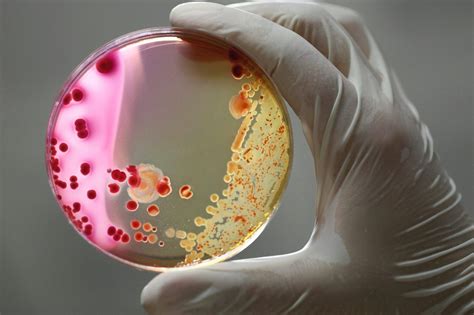 Refrigeration Explained: How Temperature Affects Bacterial Growth