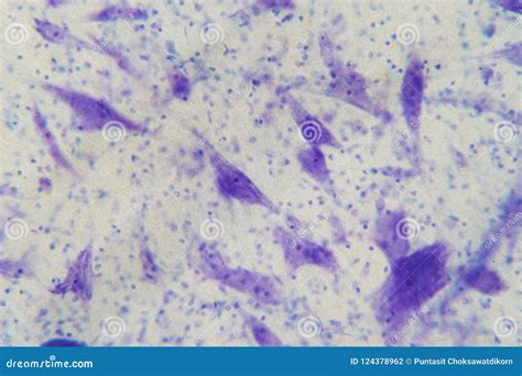 Image result for Brain Under Microscope