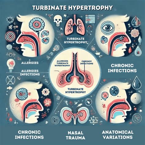 Nasal Turbinate Reduction Surgery in Beverly Hills | Zandifar MD