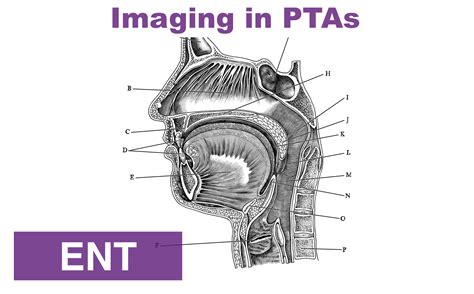 Uvular Edema — NUEM Blog