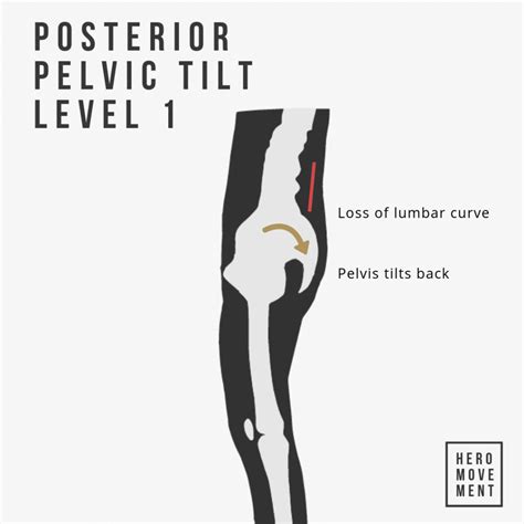 How to Fix Posterior Pelvic Tilt: Guide + Routine » HERO Movement