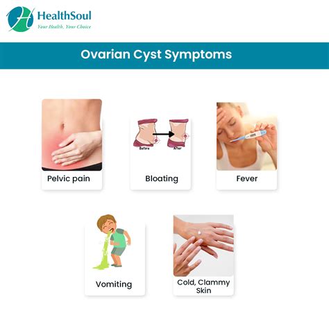 Symptoms Of A Cyst Burst