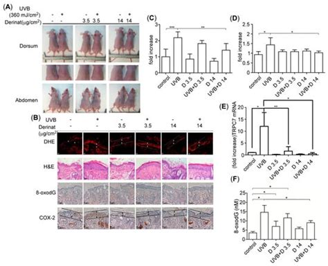 Derinat Protects Skin against Ultraviolet-B (UVB)-Induced Cellular Damage