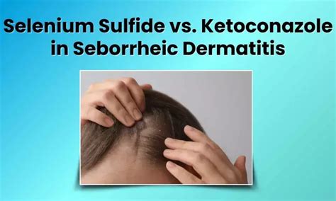 A Comparative Analysis: Selenium Sulfide vs Ketoconazole in Seborrheic ...