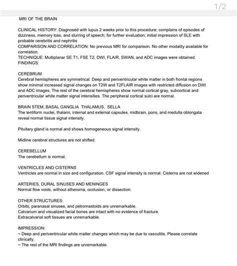 27F. MRI results - Meaning of deep and periventricular white matter ...