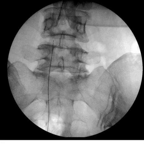 Cr System - C Arm Machine Manufacturer from Jalandhar