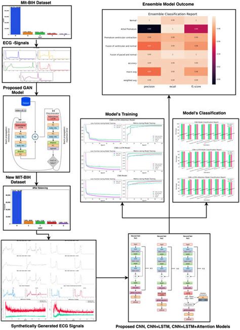 GAN-SkipNet: A Solution for Data Imbalance in Cardiac Arrhythmia ...