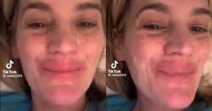 Had to use high doses of corticosteroids: Hailey Bieber’s Rhode faces ...