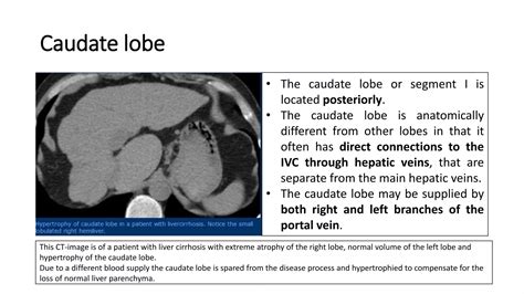 Anatomy of liver | PPTX