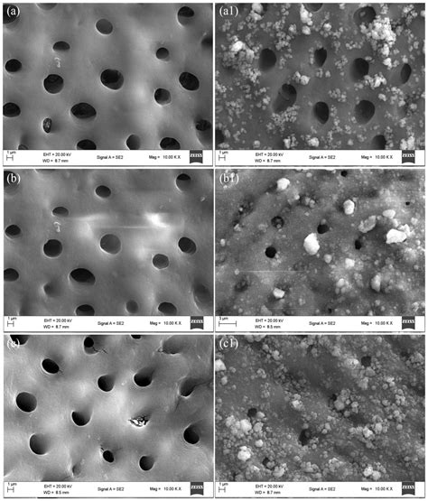 Comparative assessment of the remineralization characteristics of nano-hydroxyapatite extracted ...