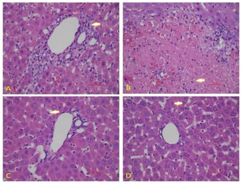 Diosmin Alleviates Doxorubicin-Induced Liver Injury via Modulation of ...