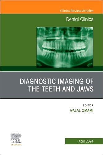 Buy Diagnostic Imaging of the Teeth and Jaws, An Issue of Dental ...