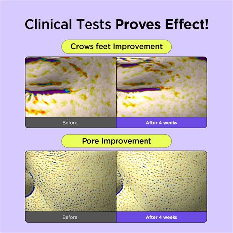 BYWISHTREND Wishtrend Vitamin A-mazing Bakuchiol Night Cream - India | Ubuy