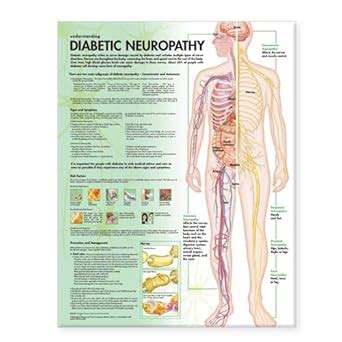 Buy Understanding Diabetic Neuropathy Anatomical Chart Book Online at ...