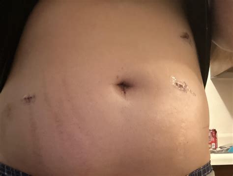 My Belly Button Hurts 的图像结果