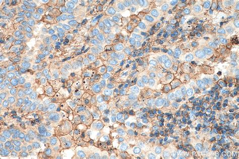 CD44 antibody (15675-1-AP) | Proteintech