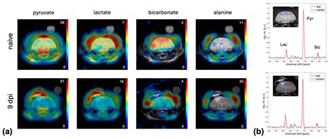 Metabolic Imaging of Hyperpolarized [1-13C]Pyruvate in a Ferret Model ...