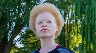 Image result for Albino Dwarf