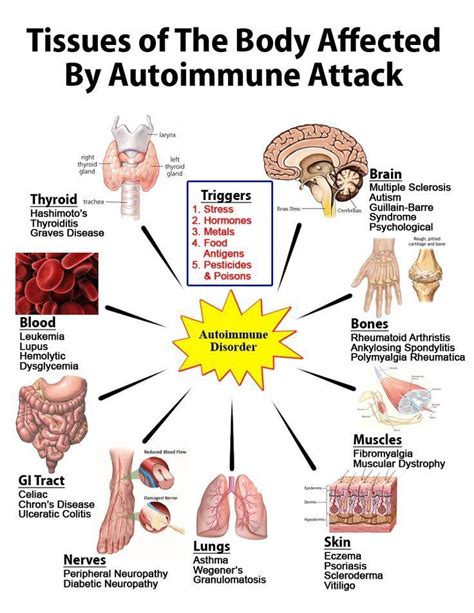 immune system attacking nerves