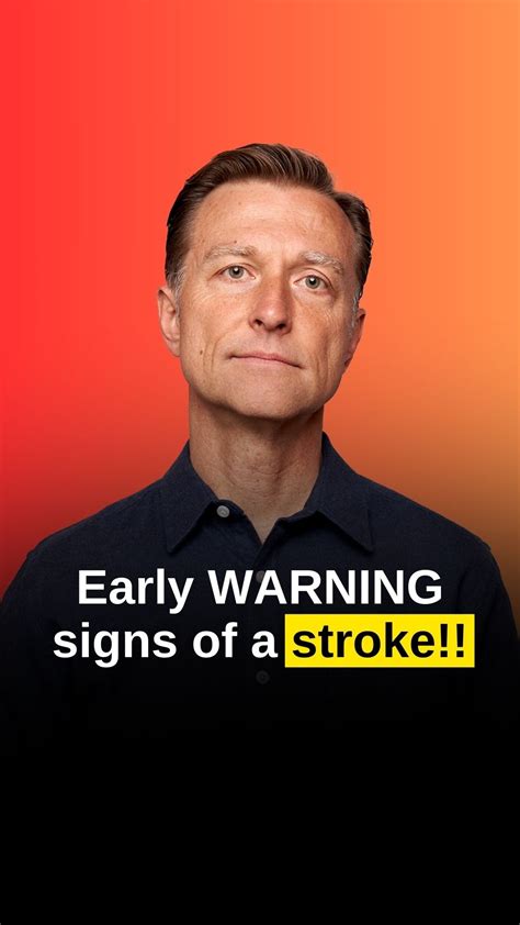 Stroke Facts