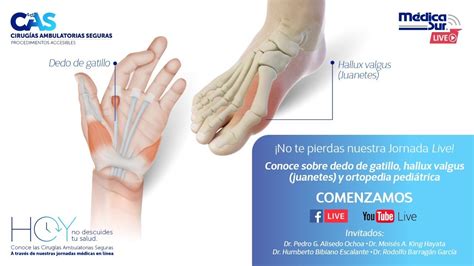 Controles incorrectos del gatillo